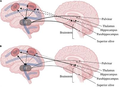 Hyper and hypo attention networks activations affect social development in children with autism spectrum disorder